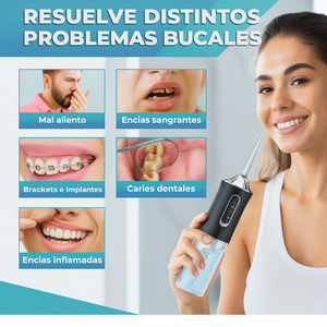 Limpiador bucal de alta presion 💧🦷